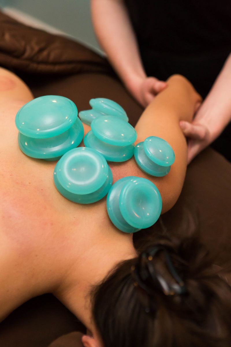 Melanie S Bruno offers Neuromuscular Cup Therapy, Myofascial Decompression Cup Therapy, Cupping, Vacuum therapy, cupping, cup therapy, 